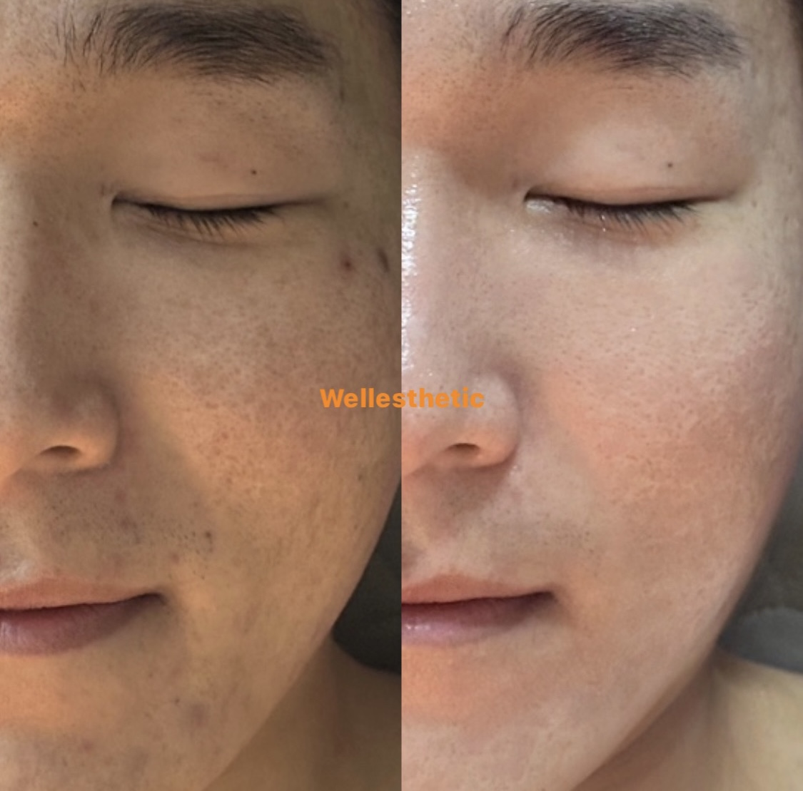 d2c39eb9760522e22a9448366a50642a_1702975450_2541.jpg d2c39eb9760522e22a9448366a50642a_1702975450_2541.jpg