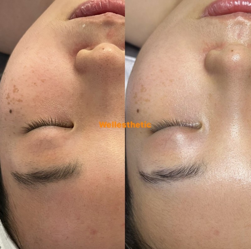 d2c39eb9760522e22a9448366a50642a_1702975450_4395.jpg d2c39eb9760522e22a9448366a50642a_1702975450_4395.jpg