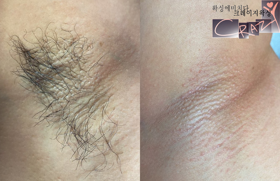 bf2a2ef42df5f410e2d2d0460d29d19c_1706851146_9565.jpg bf2a2ef42df5f410e2d2d0460d29d19c_1706851146_9565.jpg