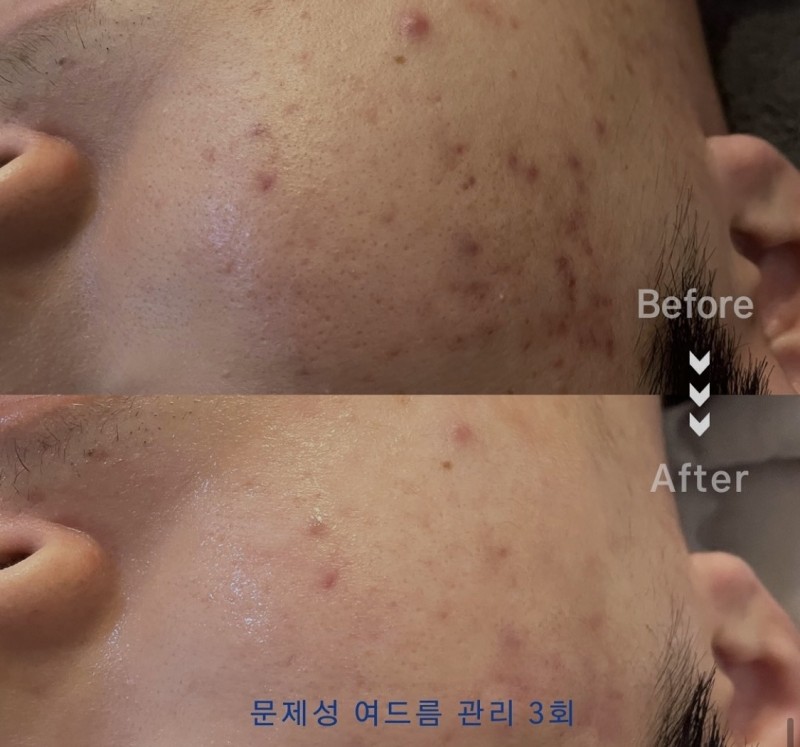 c53d54205f35a745935c8e4981879c18_1711006876_3148.jpg c53d54205f35a745935c8e4981879c18_1711006876_3148.jpg