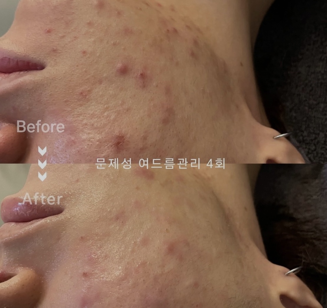 c53d54205f35a745935c8e4981879c18_1711006876_5772.jpg c53d54205f35a745935c8e4981879c18_1711006876_5772.jpg