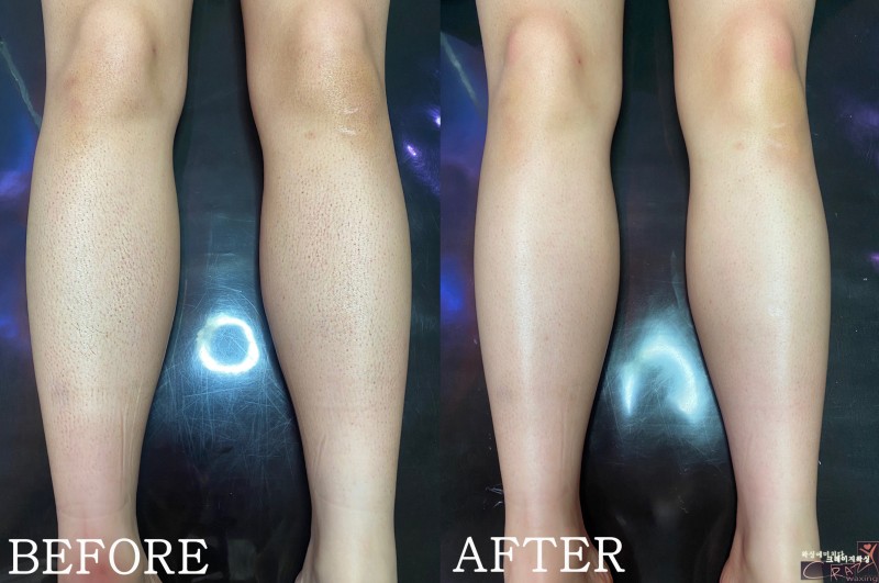 cdaf3a4578229d202711145f104b923e_1709615996_5827.jpg cdaf3a4578229d202711145f104b923e_1709615996_5827.jpg