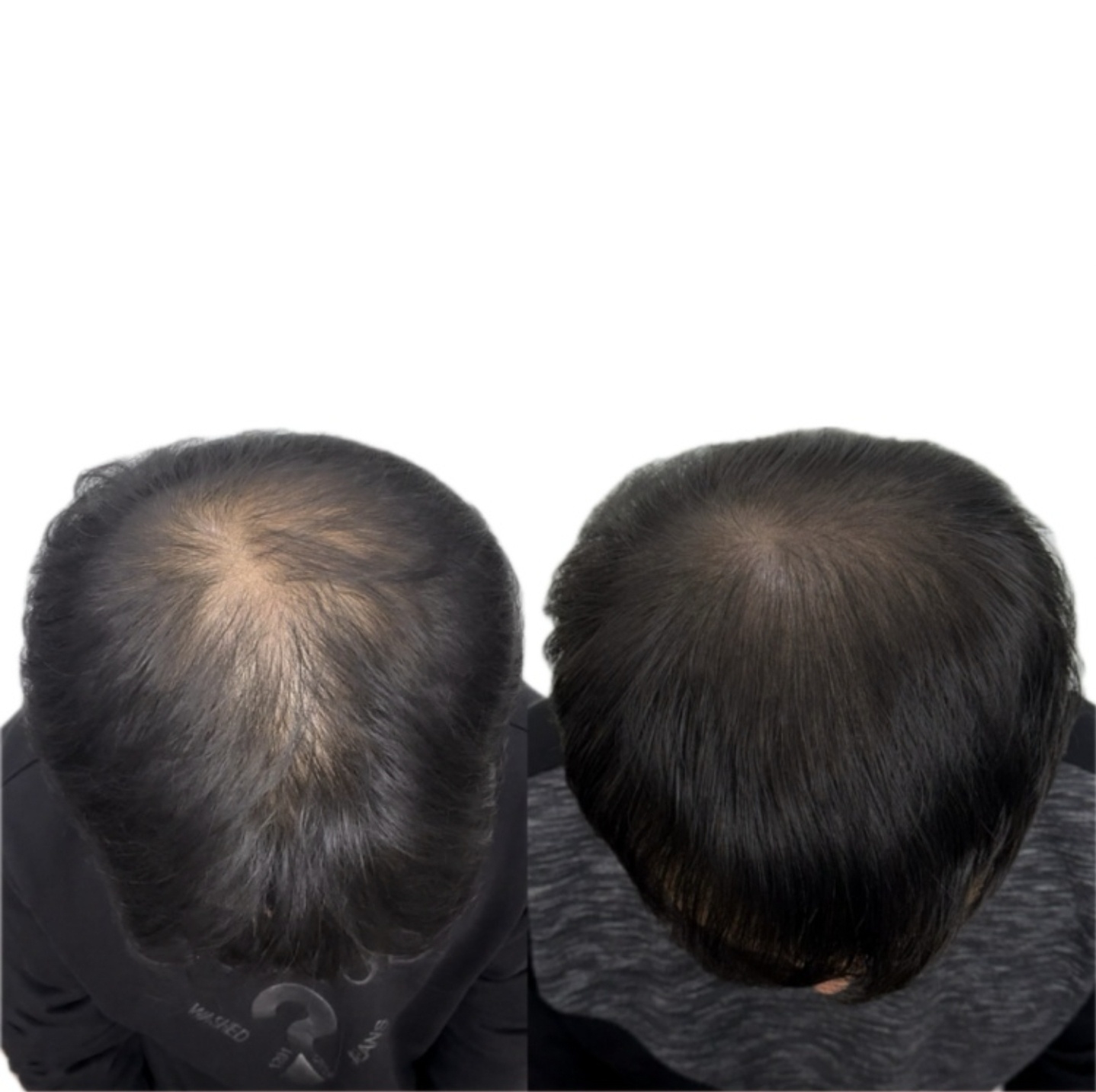 d624732c4d6b5f35f5940a6db5f504fd_1711932823_4608.jpg d624732c4d6b5f35f5940a6db5f504fd_1711932823_4608.jpg