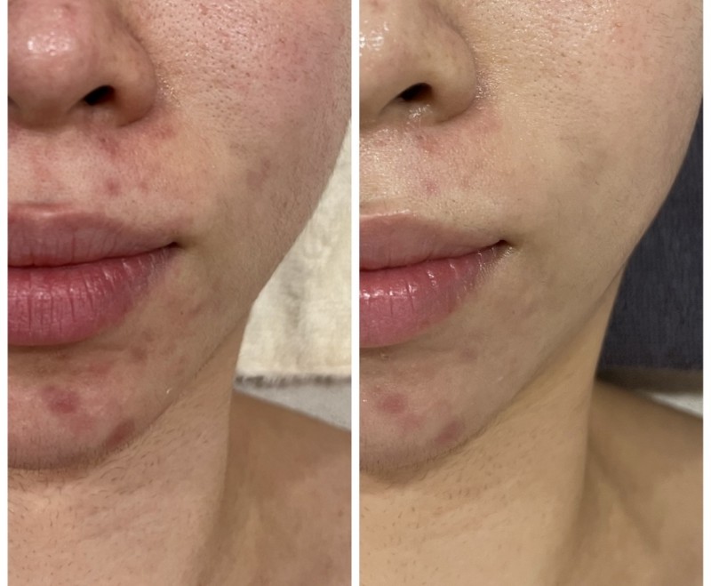 cb7e2f5bdc0538e81ca8d7ec187bb8c7_1715675715_8764.jpeg cb7e2f5bdc0538e81ca8d7ec187bb8c7_1715675715_8764.jpeg