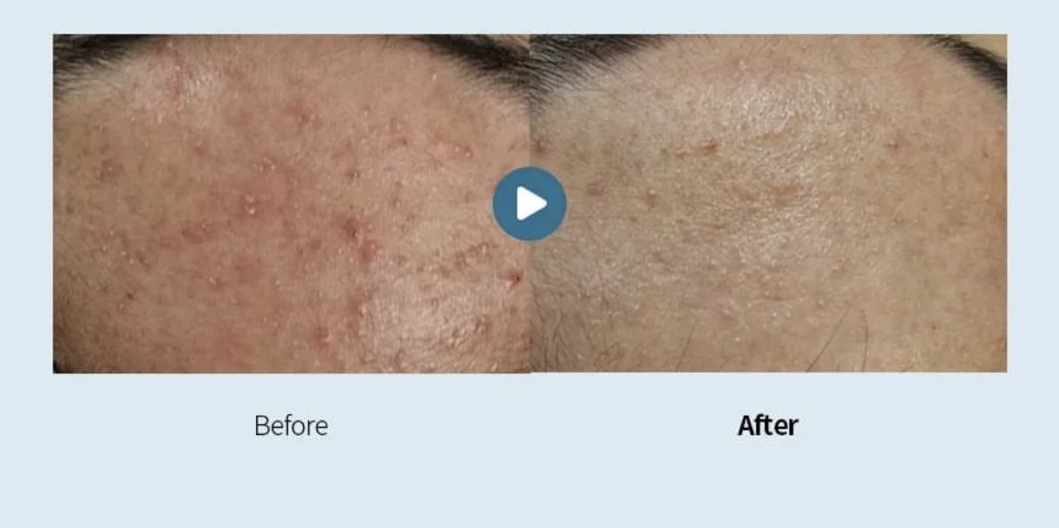 cb7e2f5bdc0538e81ca8d7ec187bb8c7_1715675722_3634.jpeg cb7e2f5bdc0538e81ca8d7ec187bb8c7_1715675722_3634.jpeg