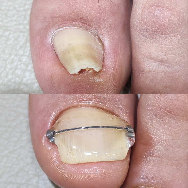 5778781a7321c7810d20612f6acf04f4_1739980523_3958.jpg 5778781a7321c7810d20612f6acf04f4_1739980523_3958.jpg