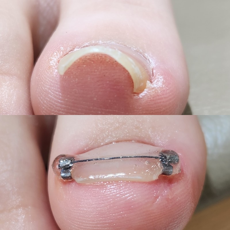 5778781a7321c7810d20612f6acf04f4_1739980523_8551.jpg 5778781a7321c7810d20612f6acf04f4_1739980523_8551.jpg