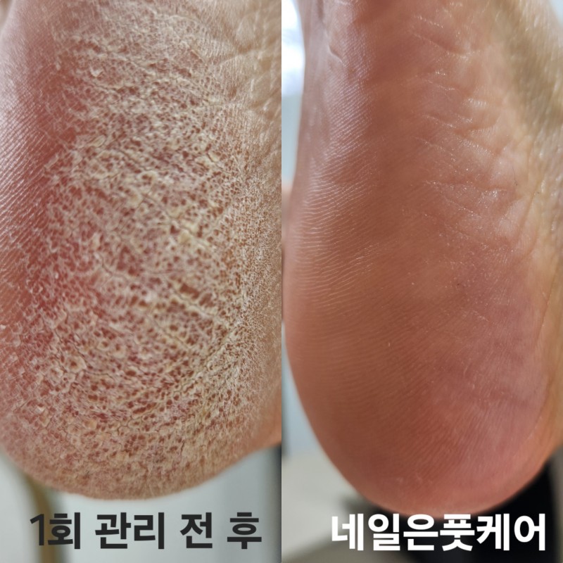 5778781a7321c7810d20612f6acf04f4_1739980524_3471.jpg 5778781a7321c7810d20612f6acf04f4_1739980524_3471.jpg