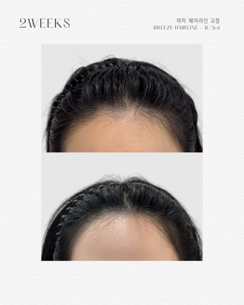 fa30625b4ba38ff74c1aa212ce178e6d_1761815046_6714.jpg fa30625b4ba38ff74c1aa212ce178e6d_1761815046_6714.jpg