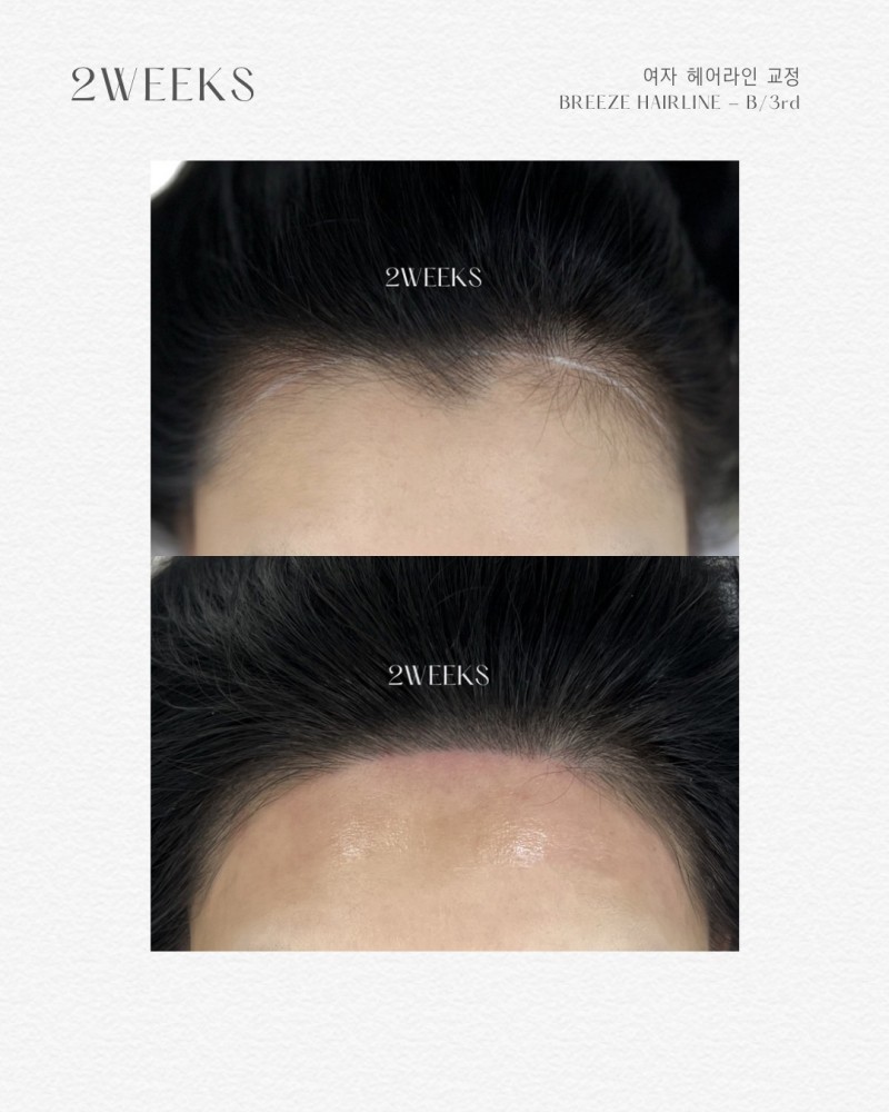 fa30625b4ba38ff74c1aa212ce178e6d_1761815046_8112.jpg fa30625b4ba38ff74c1aa212ce178e6d_1761815046_8112.jpg