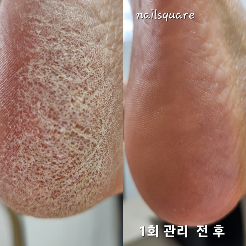 e21037387469dea642279deb45d7f36e_1763809772_7894.jpg e21037387469dea642279deb45d7f36e_1763809772_7894.jpg